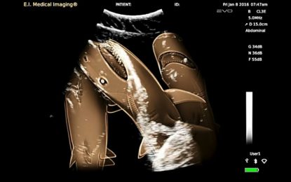 La impresionante ecografía de una hembra de tiburón embarazada