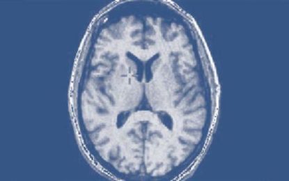 Descubre 6 movimientos que tu cerebro hace “sin permiso”