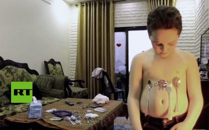 El ‘niño magnético’: Este menor atrae objetos de metal como si tuviera un imán en su barriga (VIDEO)